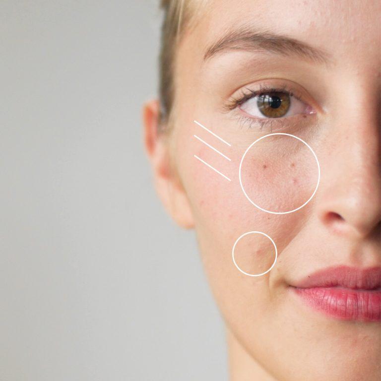 How We Age: Best devices for Teenage Skin