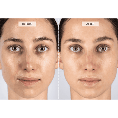 CurrentBody Skin LED Lysterapi Maske