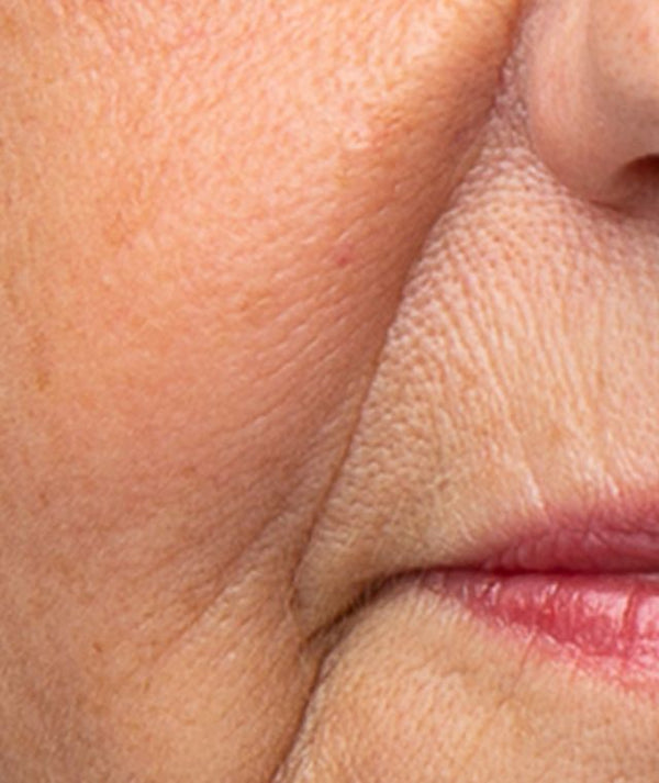 Anti-ageing teknologi